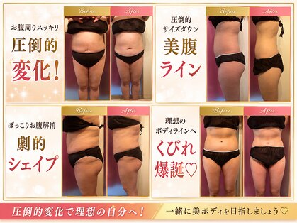 リンパケアサロン ジュビル(Jubil)の写真