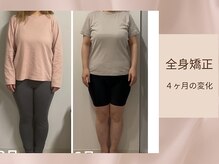 骨格美容サロン/全身矯正の変化