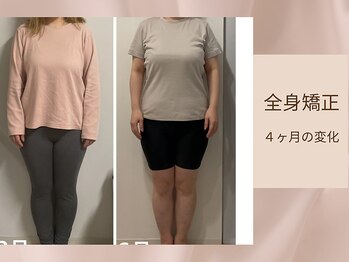 骨格美容サロン/全身矯正の変化