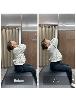 ナオル整体 武蔵小杉院(NAORU整体)/20代女性　背骨の柔軟性