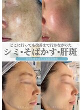 リメイクビューティークリニック(REMAKE BEAUTY CLINIC) 若返り 根本施術