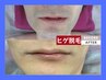 【見た目＆剃刀負け改善】メンズヒゲ脱毛★夏集中コース／効果保証あり！