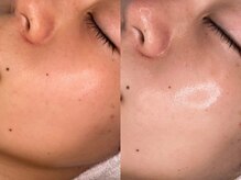 フェイシャルクレア(Cre A.)/