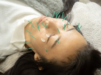 リアン(Re:an)/美容鍼施術の流れ