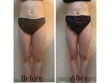 リブ 三軒茶屋(LiB)/下半身悩みも改善