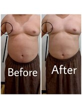 エミナル(EMINAL)/６０分のウィンバック効果　前