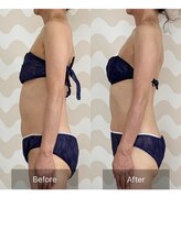 トリムリターン 三重伊賀店Mana/お腹の縮みを解き、すっきり整う