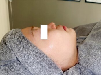 ペルル(Perle)の写真/本格肌質改善★お肌悩みにあわせたのピーリングと、美容液で徹底ケア♪ふっくらハリツヤに満ちた憧れの肌へ