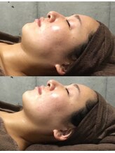 アネル 豊見城(anel)/