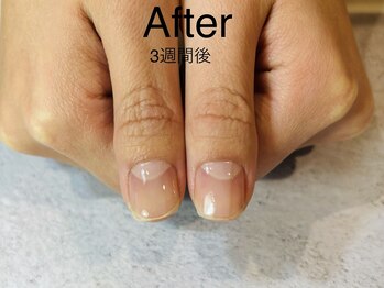 アンドネイル 海老名(&nail)/自爪育成ジェル　3週間後