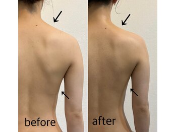 ニコ(25)/オーダーメイド筋膜リリース