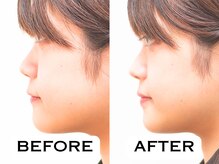 ビハリスト 恵比寿/お顔のむくみが改善