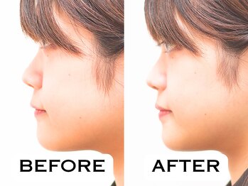 ビハリスト 恵比寿/お顔のむくみが改善