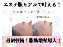 メディカルエース(MedicalAce)の雰囲気（結果重視☆専門知識を有するスタッフの信頼の施術です！）