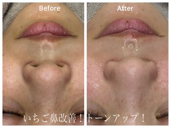 フィー(Fee)/すっぴん恥ずかしくないお肌へ♪