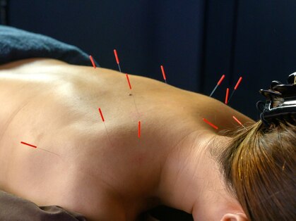 Grow-up鍼灸治療院の写真