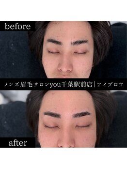 ユー 千葉駅前店(you)/ビフォ－アフター写真