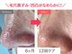 メープルサロン(MAPLE SALON)の写真