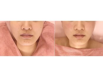 小顔美肌コルギ専門店 センティード 吉祥寺(Sentido)/施術写真