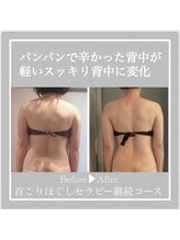 ミラトータルビューティ(Mira Total beauty)/首から整う美と健康