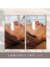 ルーク(Luke)/ビフォーアフター