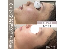 モアトゥインクル 福山宮通り店(MORE twinkle)