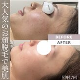モアトゥインクル 福山宮通り店(MORE twinkle)