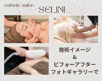 セリーニ(Selini)