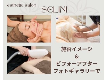 セリーニ(Selini)