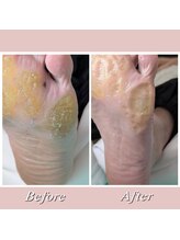 巻き爪補正店 大阪なんば店/たこ・魚の目