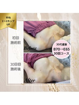 ロココ 町田店(Rococo)/B→Eの3カップUP!