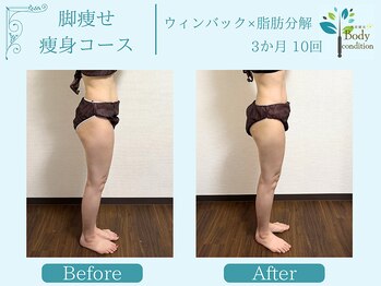 ボディコンディション/ウィンバック/痩身/小顔毛穴洗浄