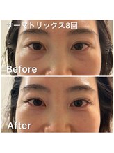 デディア 恵比寿(dedia)/目元のクマをなかったことに