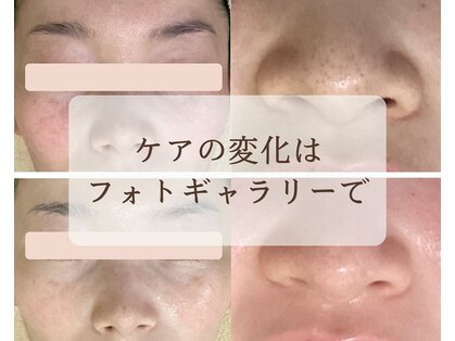 こもれびの写真