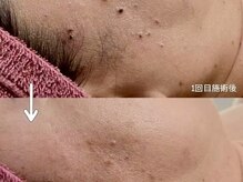 クレビア(CREBIA)/【シミ・シミケア専門店】沖縄県