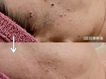 クレビア(CREBIA)/【シミ・シミケア専門店】沖縄県