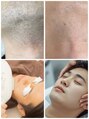 ルミネル 名古屋新栄(Luminelle) 初めての男性も完全個室で安心