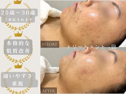 ピュア(pure)の写真