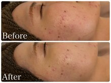 ブリエ(Briller)/オプションなし！