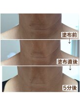 ミュウ(miuex)/年齢が出る首元に