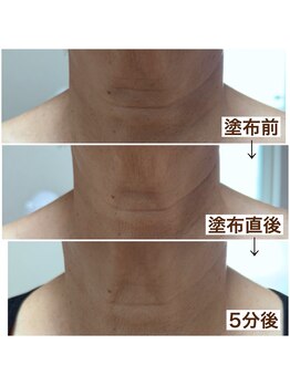 ミュウ(miuex)/年齢が出る首元に