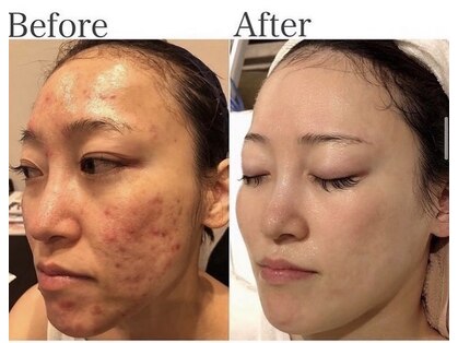 ハイケア グラン ギンザ(HYCARE GRAND GINZA)の写真
