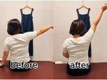 オン鍼灸整体院(ON鍼灸整体院)/整体&鍼灸/ビフォーアフター