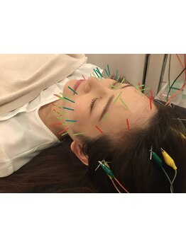 小顔になりたい