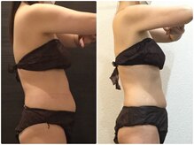 美容整体ウェリナ あま甚目寺院/小顔矯正/骨盤矯正/美脚サロン