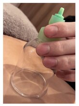 いつき整体院 樫原店/吸玉×エステぽかぽかスッキリ♪