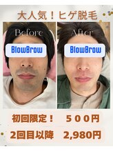 ブロウブロウ(Blow Brow)/初回！ヒゲ脱毛500円