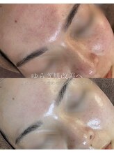 ウェリスト まこトレ整体院(WELIST)/before after