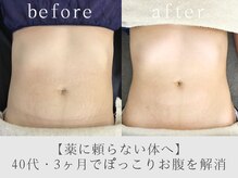 エイル(Eir.)
