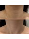 ソアン(Soin)の写真/未来を纏う肌へ、上質なシワ予防ケア